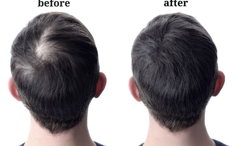 How To Thicken Hair?